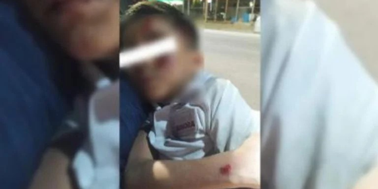 Atropellan a niño al salir de clases al norte de Hermosillo; conductora ya contactó a familia