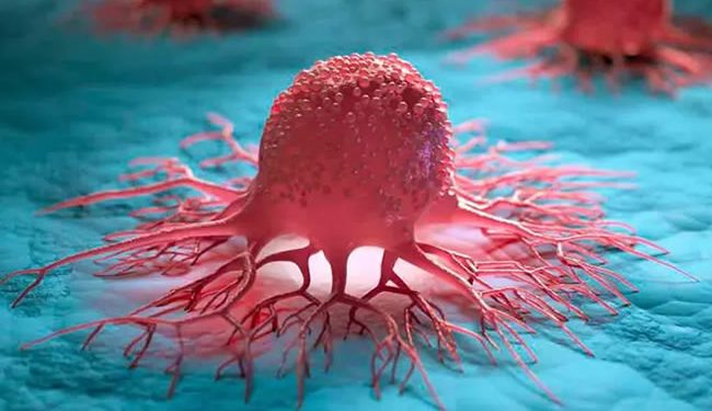 Hombre de Arizona muere tras contraer cáncer de su donante de órganos