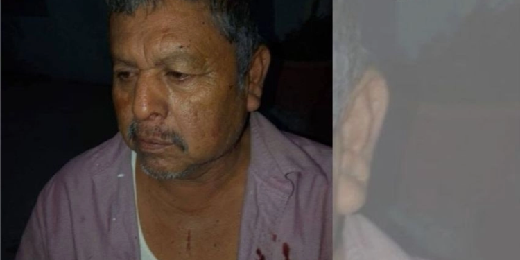 Atacan a golpes a líder tradicional yaqui y a otro miembro de la etnia en Sonora