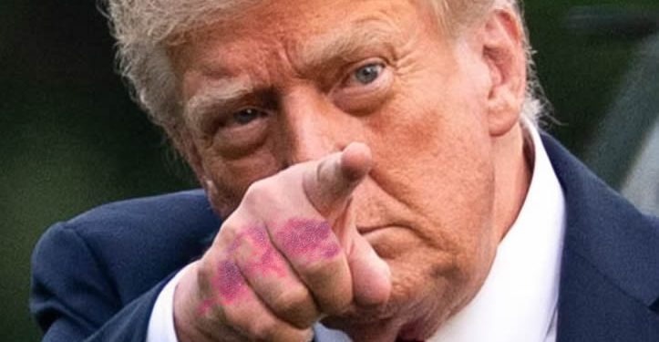 ‘Apretones de mano’ y aspirina: La explicación de los moretones de Donald Trump