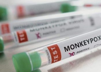 Dan de alta a los dos pacientes con viruela símica confirmados en Sonora