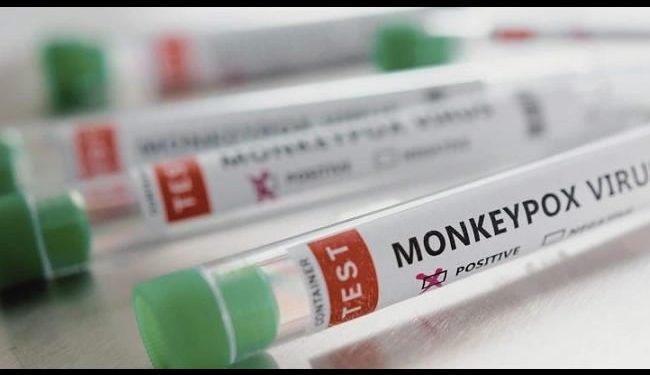 Siete personas son evaluadas clínicamente para confirmar o descartar viruela símica