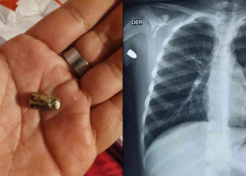 Balacera se desata en celebración de Año Nuevo en Nogales; bala perdida alcanza a niño de 8 años