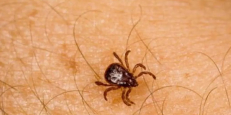 Sonora en alerta ante aumento de letalidad por rickettsiosis; Hermosillo, el municipio más afectado