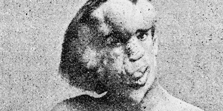 Los placeres ocultos, su trabajo como fenómeno de circo y la atormentada vida del “hombre elefante”: “Soy una persona con alma”