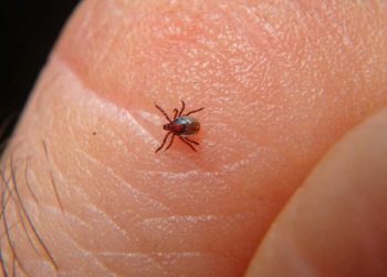 Ocupa Sonora primer lugar nacional en muertes por rickettsia