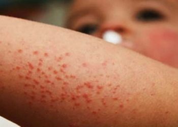 Instalan macrocentros de vacunación contra sarampión en Sonora