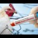 IP advierte que próxima gran crisis de salud pública será influenza aviar
