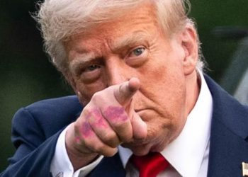 ‘Apretones de mano’ y aspirina: La explicación de los moretones de Donald Trump