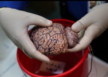 El descubrimiento del papel esencial del litio en el alzhéimer abre un esperanzador frente para tratar la enfermedad