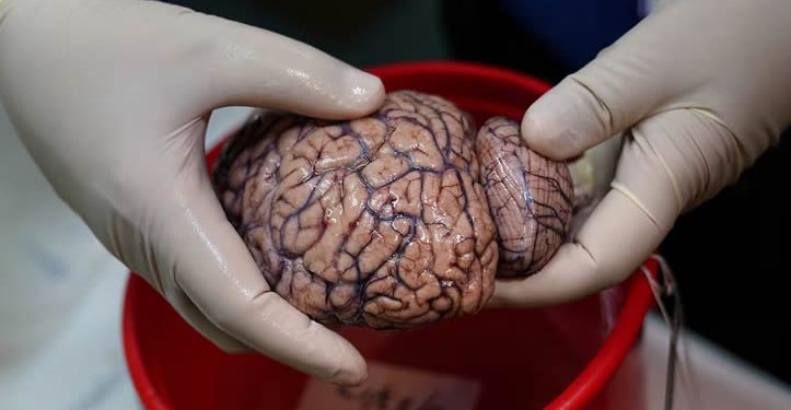 El descubrimiento del papel esencial del litio en el alzhéimer abre un esperanzador frente para tratar la enfermedad