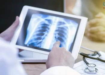 ¡Alerta por tuberculosis! Este es el estado que concentra el 50% de los contagios