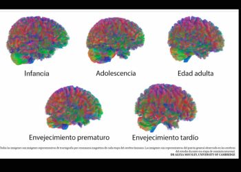Las cinco ‘edades’ del cerebro humano: hay cambios cruciales alrededor de los 9, los 32, los 66 y los 83 años