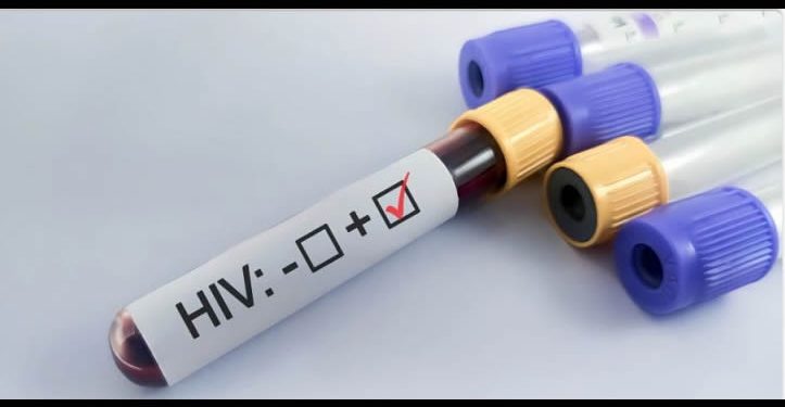 2025: Sonora registra 288 casos de VIH