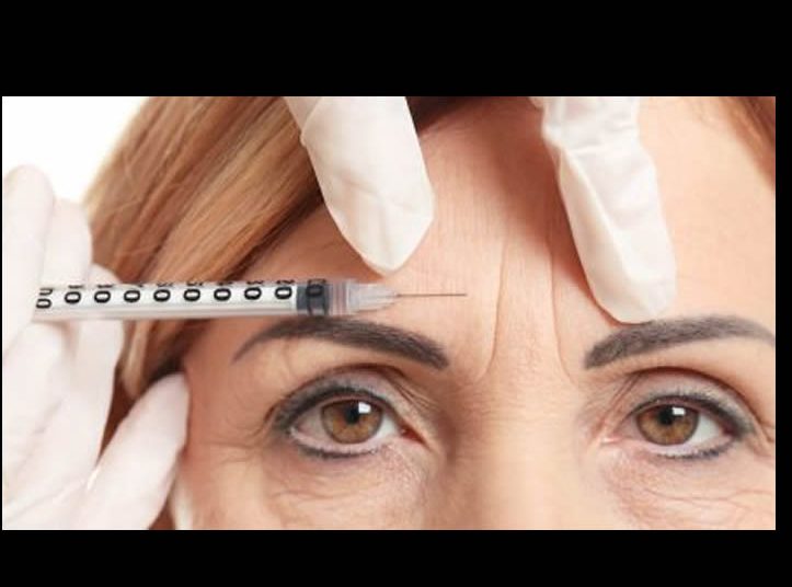 El impacto del bótox tras años de uso: lo que la ciencia revela sobre la adaptación muscular
