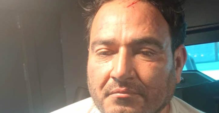 ‘El Botox’: perfil criminal del ‘objetivo prioritario’ capturado por el Gabinete de Seguridad