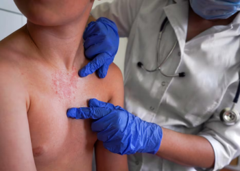 Un contagio por hora: la epidemia de sarampión que México no pudo frenar