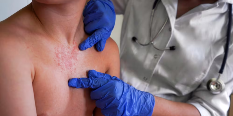 Un contagio por hora: la epidemia de sarampión que México no pudo frenar