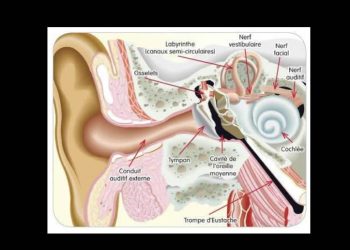 ¿Qué es el Test de Escucha Tomatis?