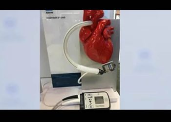 Implante de corazón artificial: alternativa para pacientes terminales