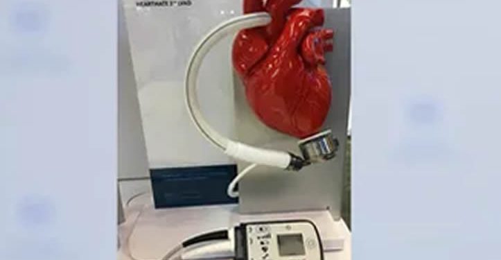 Implante de corazón artificial: alternativa para pacientes terminales