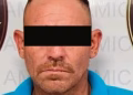 Vinculan a proceso a hombre por presuntamente amputar nariz y labio a joven en SLRC; víctima fue atacada con machete