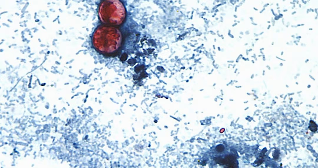 EU reporta primeras dos muertes por “diarrea explosiva” a causa de cyclospora; suman más de 4 mil casos confirmados