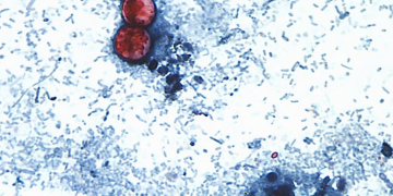 EU reporta primeras dos muertes por “diarrea explosiva” a causa de cyclospora; suman más de 4 mil casos confirmados